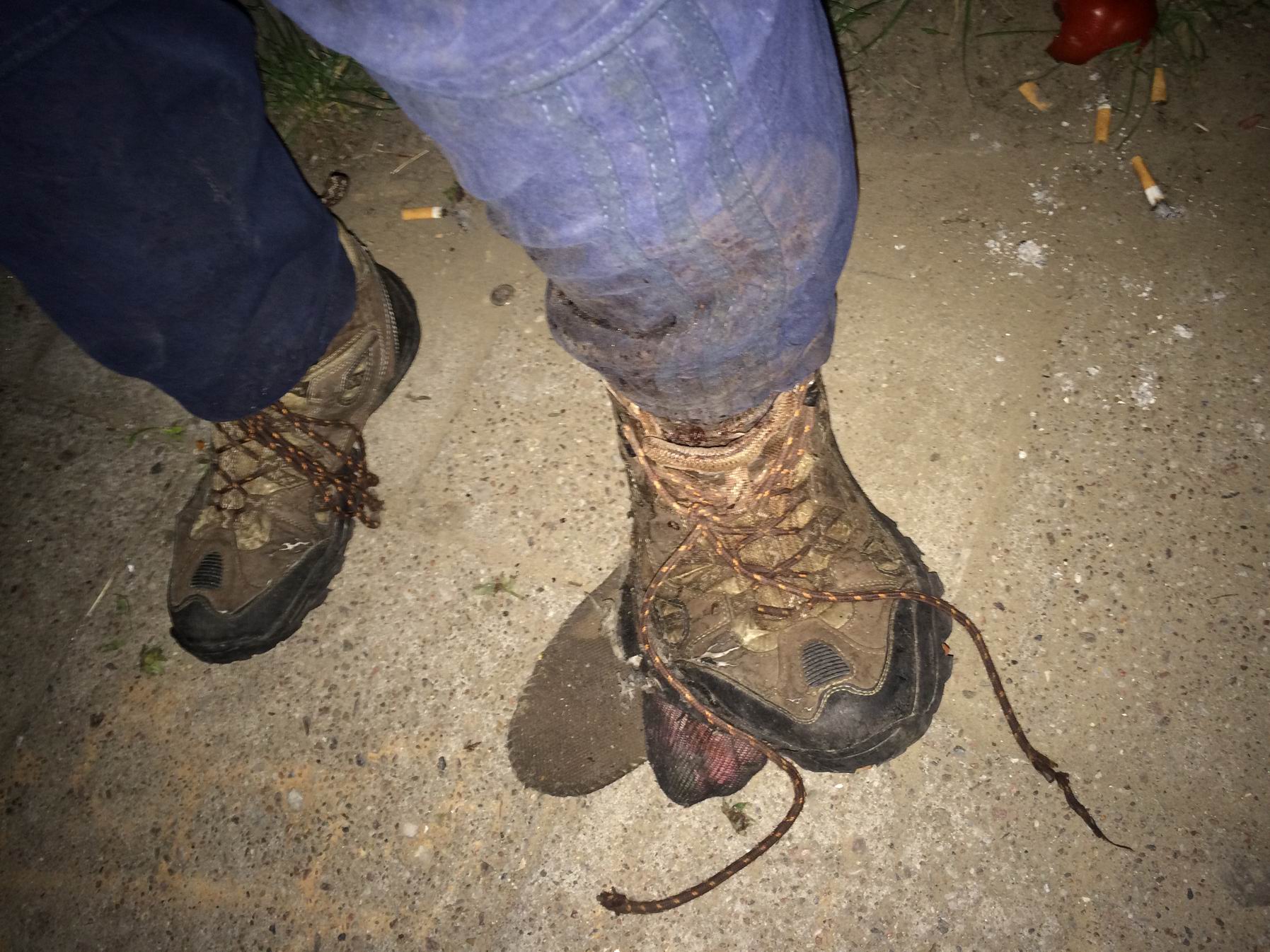 Bezdomny Noga Fundacja Ja Jestem